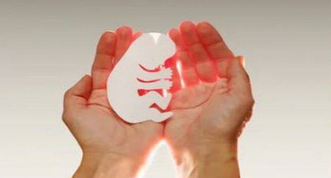 unsafe-abortion