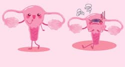 Suffering from ovarian cancer? These home remedies may help