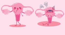 Suffering from ovarian cancer? These home remedies may help