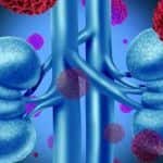 Kidney cancer: All you need to know about the treatment options