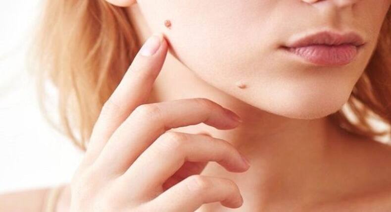 Skin cancer: Know these risk factors
