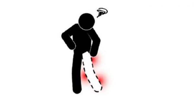 Numbness, multiple sclerosis