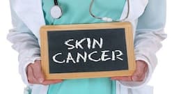 Skin cancer: Know these risk factors