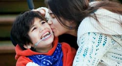 Children with cerebral palsy may have improved walking ability after surgery