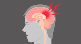 Recovering from concussion? Try these home remedies to speed up your healing process