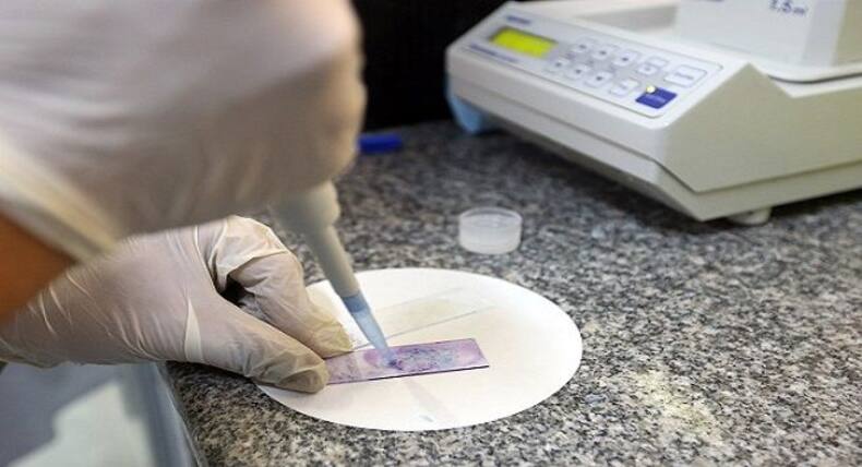 Diagnosing spinal muscular atrophy