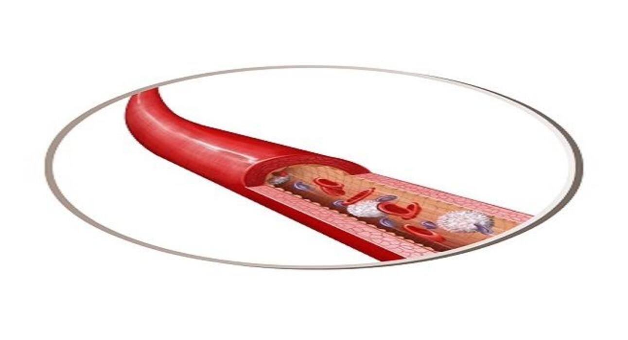 Here are the 5 most common blood disorders you should know about
