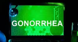 Did you know? A weakened immune system can lead to gonorrhea