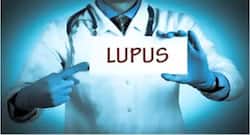 World Lupus Day 2019: The best and worst foods for this condition