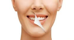 दांतों और मसूड़ों में होने वाले टारटार और प्लेक से कैसे बचें