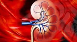 Kidney cancer: know about these risk factors