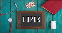 World Lupus Day: Childhood trauma and other risk factors behind SLE