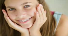 Braces cannot bring happiness, self-confidence: Study Braces cannot bring happiness, self-confidence: Study