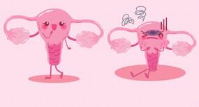 New test can eliminate need for surgery to diagnose ovarian cancer