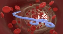 खतरनाक है इबोला वायरस, रहें सावधान!