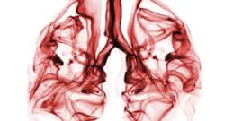 लंग कैंसर (Lung Cancer) का बढ़ रहा है खतरा, जानें बचाव के आसान उपाय