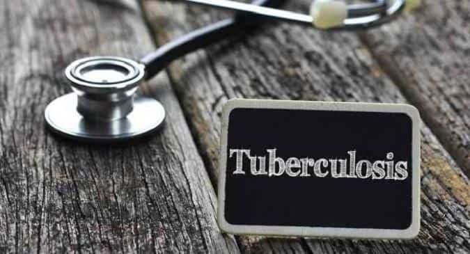 Scientists identify master cell playing key role in fighting TB