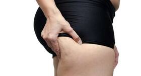 10 essential oils to fight against cellulite