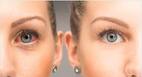 Conjunctivitis : आंखें लाल हैं तो हो सकता है कंजंक्टिवाइटिस, जानें लक्षण, कारण और उपचार