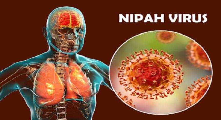 Nipah virus infection: Here are 4 effective ways to prevent it ...