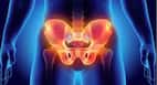 Are Vegetarian Women More Prone To Hip Fractures? Research Reveals