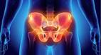 Are Vegetarian Women More Prone To Hip Fractures? Research Reveals