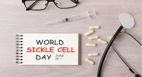 world sickle cell day 2020 in Hindi, सिकल सेल रोग क्या है, सिकल सेल डिजीज के लक्षण, कारण, इलाज