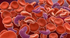 Super foods to fight anaemia