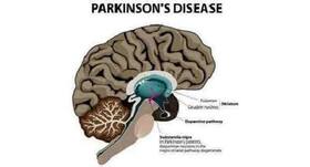 Try our tips for a better life post Parkinson’s