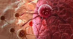 Chinese scientists develop tumor-specific anti-cancer therapy