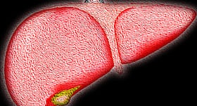 Expert Speak: Importance of regular check-up for fatty liver disease Expert Speak: Importance of regular check-up for fatty liver disease