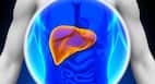 Lead poisoning can cause fatty liver, natural remedies can rectify it