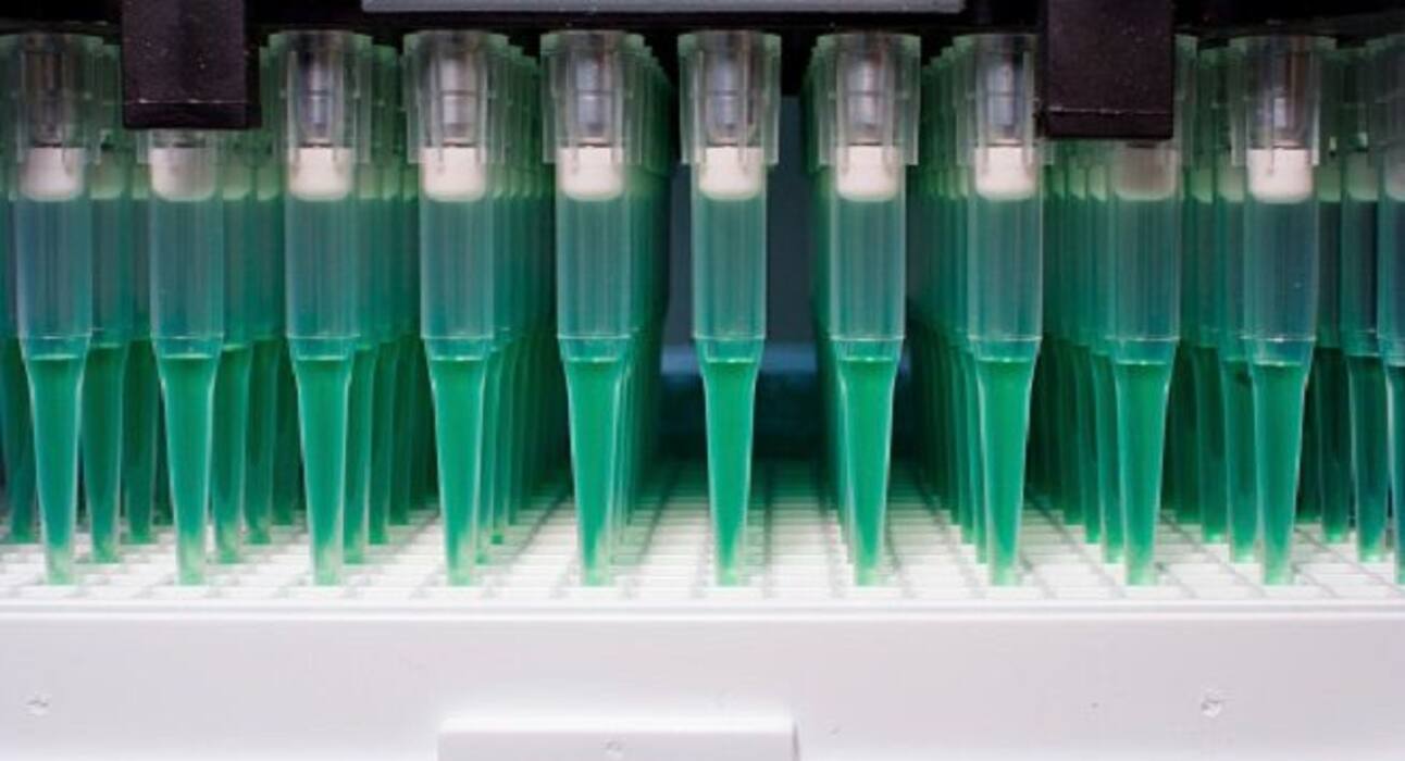 HIV: This is how it is being diagnosed