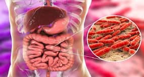 Gut bacteria can affect health: Novel 3D pill to collect samples Gut bacteria can affect health: Novel 3D pill to collect samples