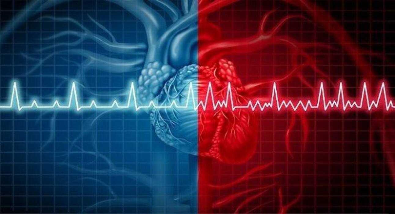 Heart attack: Factors other than diabetes linked to this condition