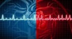 Arrhythmia