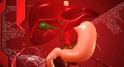 Non-alcoholic fatty liver disease: Adhere to these dietary changes to treat the condition