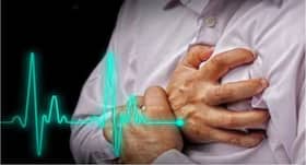 Mission Delhi: Treatment of heart attack under 10 minutes