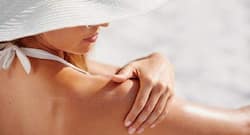 Want to get rid of sunburn? Opt for these natural remedies