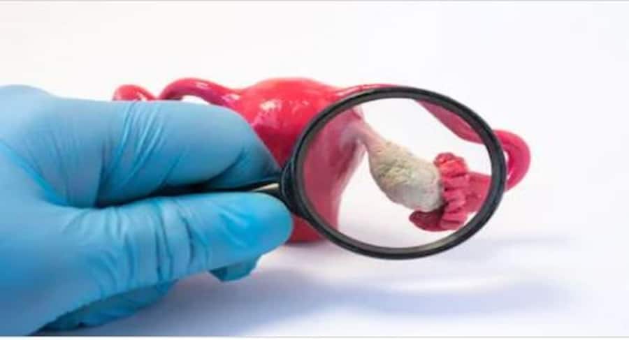 गायनेकोलॉजिकल कैंसर महिलाओं पर छिपकर कर रहा वार, बचाव के लिए करें लक्षणों की पहचान