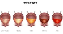 पेशाब के रंग से जानें अपनी सेहत का हाल