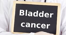Giving up smoking cuts bladder cancer risk in postmenopausal women Giving up smoking cuts bladder cancer risk in postmenopausal women