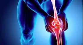 Bone fracture: These essential oils can heal it faster Bone fracture: These essential oils can heal it faster