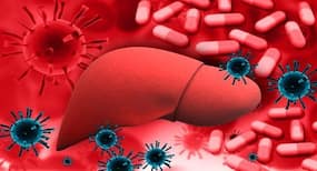 Viral Hepatitis : आम है 16 से 30 आयु वर्ग में वायरल हेपेटाइटिस, जानें इसके बारे में