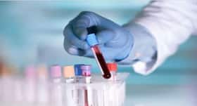 Blood Purifier Food : रक्त को शुद्ध करती हैं ये 5 चीजें, जरूर करें सेवन