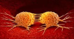 कैंसर सेल को फैट सेल में बदल कर होगा स्‍तन कैंसर का उपचार