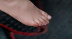 ‘शू बाइट’ में आराम दिलाएंगे ये घरेलू उपचार, जानें इस्तेमाल का सही तरीका