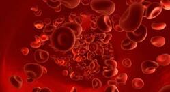 Sickle cell disease: It makes your red blood cells look like sickles