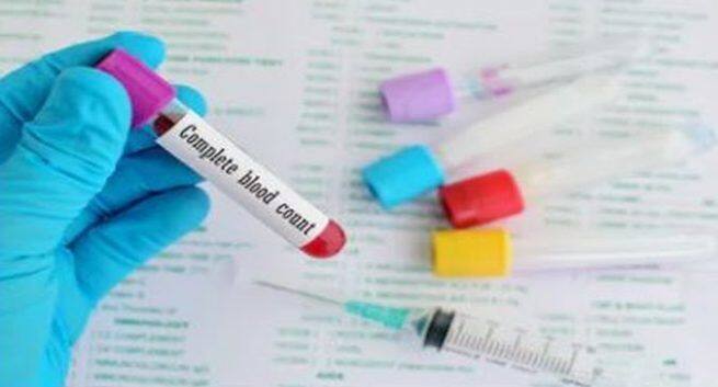 blood platelet count, Blood platelet donation, Blood platelet donation process, Dengue fever, Dengue fever treatment, blood platelet count in dengue fever. 