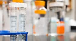 यूरिन टेस्ट से कैंसर का पता लगाया जा सकता है